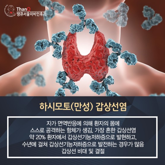 땡큐서울의원 - [송영기 원장] 감기인 줄 알았는데… 갑상선염, 방치 위험!