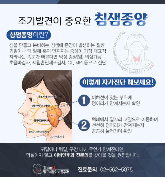땡큐서울의원 - [강영 원장] 턱 밑에 생긴 혹, 침샘 종양이라면 양성이라도 제거!