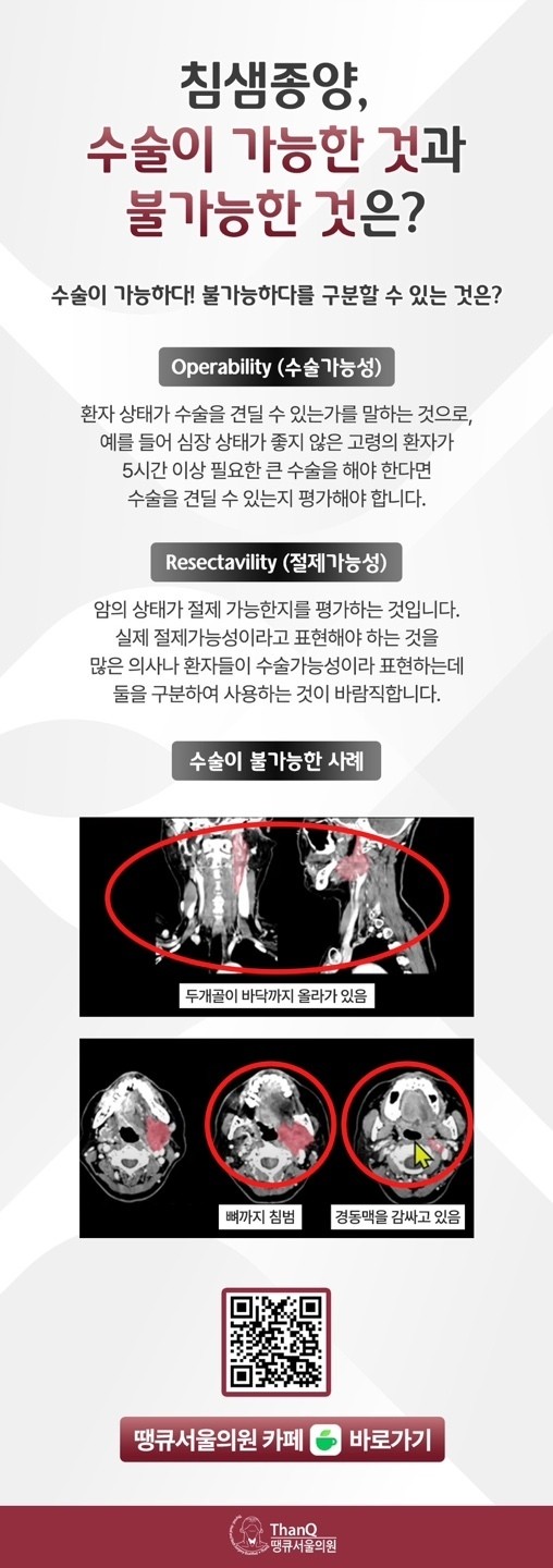 땡큐서울의원 - [강영 원장] 턱 밑에 생긴 혹, 침샘 종양이라면 양성이라도 제거!