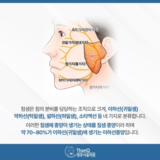 땡큐서울의원 - 이하선종양