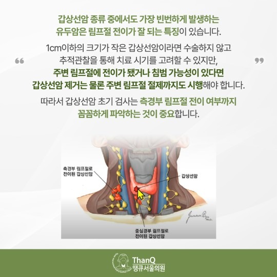 땡큐서울의원 - 갑상선암 측경부 림프절 전이