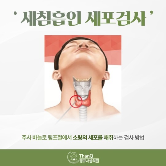 땡큐서울의원 - 갑상선암 측경부 림프절 전이