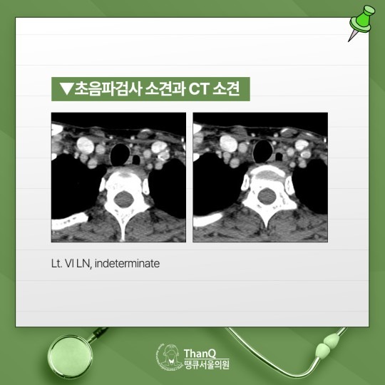 땡큐서울의원 - 갑상선암과 유방암