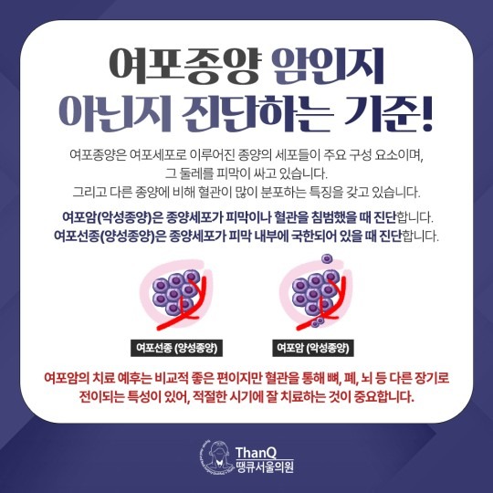 땡큐서울의원 - 갑상선 여포종양은 무엇인가?
