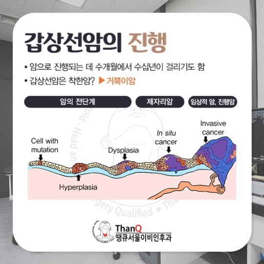 땡큐서울의원 - 작은 갑상선암