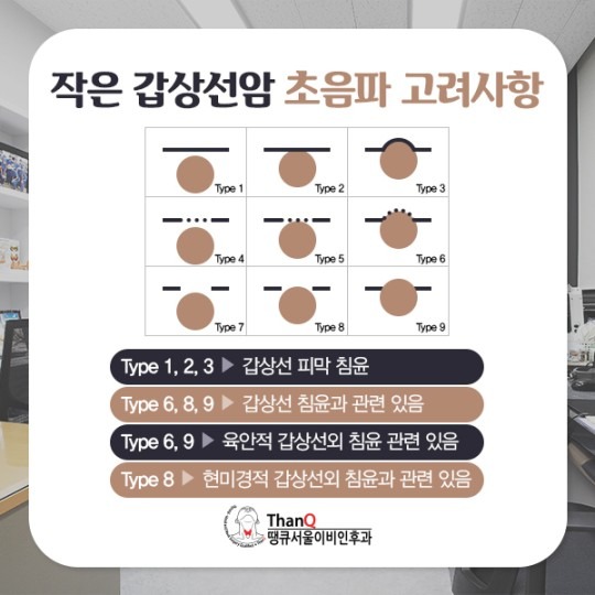 땡큐서울의원 - 작은 갑상선암