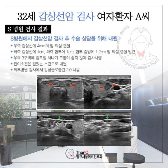 땡큐서울의원 - 갑상선 림프절전이