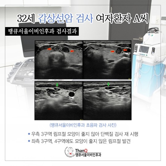땡큐서울의원 - 갑상선 림프절전이