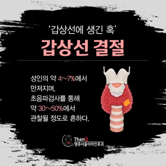 땡큐서울의원 - 갑상선결절 의심증상