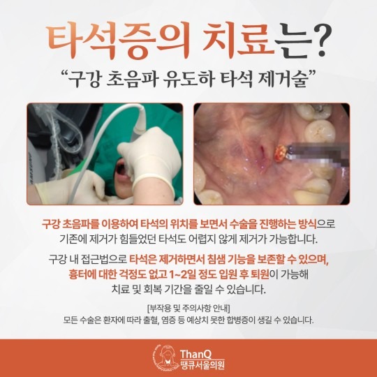 땡큐서울의원 - 타석증은 어떤 질환