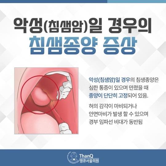 땡큐서울의원 - 침샘종양