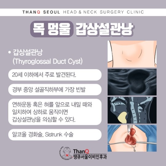 땡큐서울의원 - 목멍울