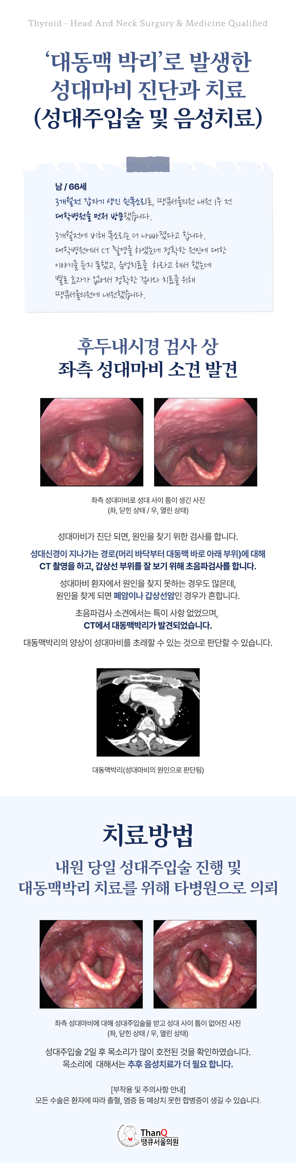 땡큐서울의원 - [성명훈 원장] 당신의 쉰 목소리, 무슨 뜻인가?